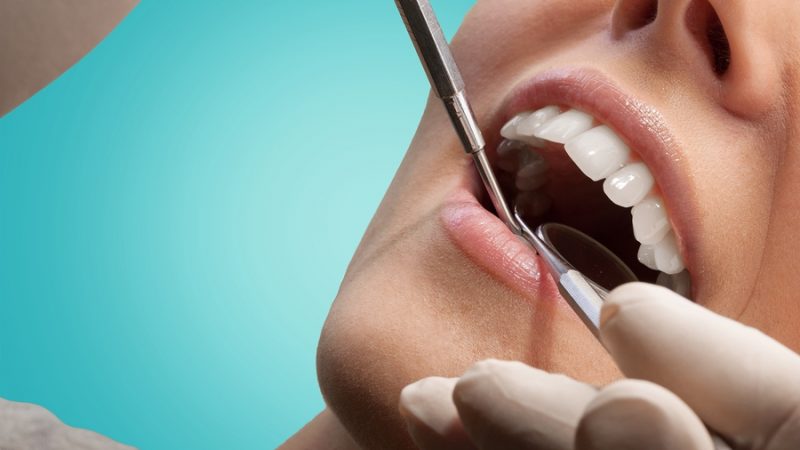 Каде отидоа моите заби низ годините?