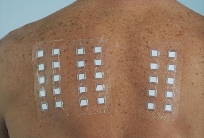 Епикутани тестови